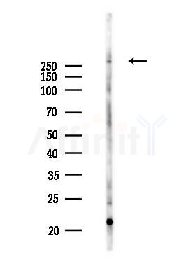 TET1 Antibody - Western blot analysis of lysates from COLO205 cells(UV 30min treatment), using TET1 Antibody at 1/1000 dilution.