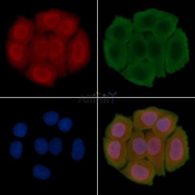 PRMT5 Antibody - DF6439 staining Hela cells(30min of UV treatment) by IF/ICC.