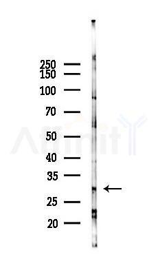 UCP3 Antibody - Western blot analysis of lysates from Mouse lung, using UCP3 Antibody at 1/1000 dilution.