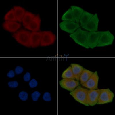 MAOB Antibody - DF6464 staining Hela cells(30min of UV treatment) by IF/ICC.