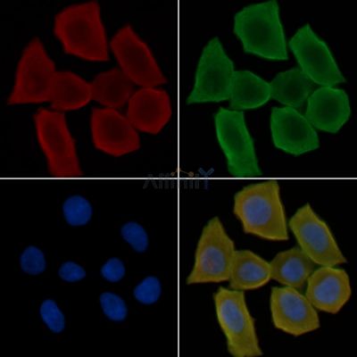 Tryptophan Hydroxylase Antibody - DF6465 staining Hela cells(30min of UV treatment) by IF/ICC.