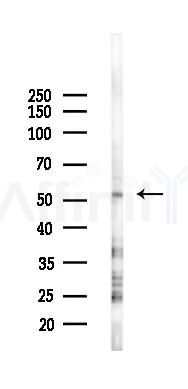 THR beta Antibody - Western blot analysis of lysates from K562 cells(starvation 24h treatment), using THR beta Antibody at 1/1000 dilution.
