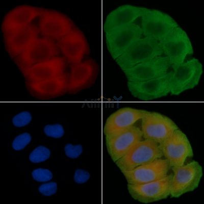 RBP4 Antibody - DF6491 staining Hela cells(30min of UV treatment) by IF/ICC.