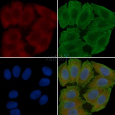 SPARC Antibody - DF6503 staining Hela cells(30min of UV treatment) by IF/ICC.