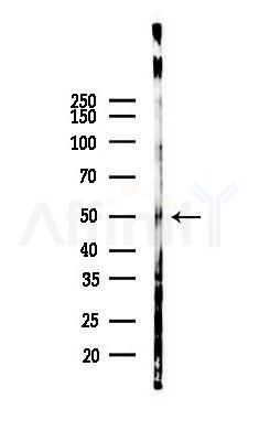 ETV6 / Tel Antibody - Western blot analysis of lysates from Mouse lung, using ETV6 / Tel Antibody at 1/1000 dilution.