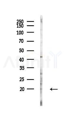 IL7 Antibody - Western blot analysis of lysates from HUVEC cells(LPS 4h treatment), using IL7 Antibody at 1/1000 dilution.