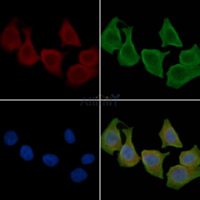 CD46 Antibody - DF6531 staining Hela cells(30min of UV treatment) by IF/ICC.