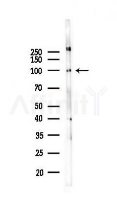 PDE4D Antibody - Western blot analysis of lysates from PC12 cells(LPS 4h treatment), using PDE4D Antibody at 1/1000 dilution.