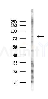 GRK2 Antibody - Western blot analysis of lysates from COLO205 cells(UV 30min treatment), using GRK2 Antibody at 1/1000 dilution.