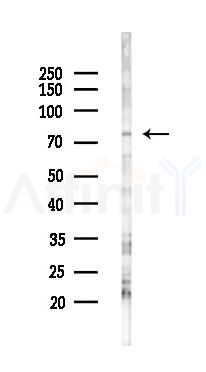 GRK2 Antibody - Western blot analysis of lysates from K562 cells(starvation 24h treatment), using GRK2 Antibody at 1/1000 dilution.