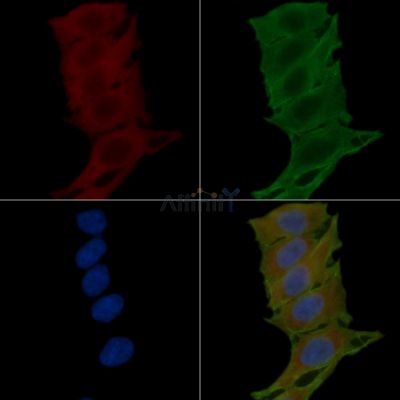Substance P Antibody - DF6541 staining Hela cells(24h of starvation treatment) by IF/ICC.