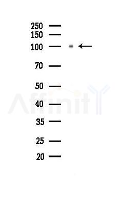 DCN Antibody - Western blot analysis of lysates from Hela cells(starvation 24h treatment), using DCN Antibody at 1/1000 dilution.