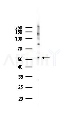 CDC25C Antibody - Western blot analysis of lysates from PC12 cells(LPS 4h treatment), using CDC25C Antibody at 1/1000 dilution.