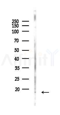 S100A8 Antibody - Western blot analysis of lysates from PC12 cells(LPS 4h treatment), using S100A8 Antibody at 1/1000 dilution.