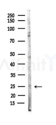 CD9 Antibody - Western blot analysis of lysates from B16F10-LUC cells(starvation 24h treatment), using CD9 Antibody at 1/1000 dilution.