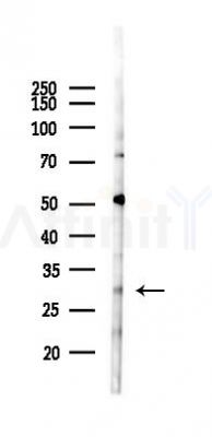 CD9 Antibody - Western blot analysis of lysates from 293 cells(LPS 4h treatment), using CD9 Antibody at 1/1000 dilution.