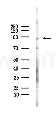TLR5 Antibody - Western blot analysis of lysates from Rat brain, using TLR5 Antibody at 1/1000 dilution.