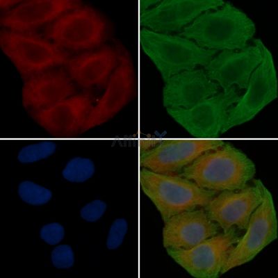 Annexin V Antibody - DF6580 staining Hela cells(30min of UV treatment) by IF/ICC.