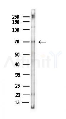 PTHR1 Antibody - Western blot analysis of lysates from B16F10-LUC cells(starvation 24h treatment), using PTHR1 Antibody at 1/1000 dilution.