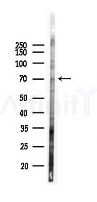 PTHR1 Antibody - Western blot analysis of lysates from 293 cells(LPS 4h treatment), using PTHR1 Antibody at 1/1000 dilution.