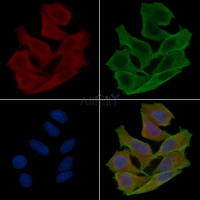 FKBP1A Antibody - DF6599 staining Hela cells(30min of UV treatment) by IF/ICC.