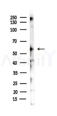 AIRE Antibody - Western blot analysis of lysates from B16F10-LUC cells(starvation 24h treatment), using AIRE Antibody at 1/1000 dilution.