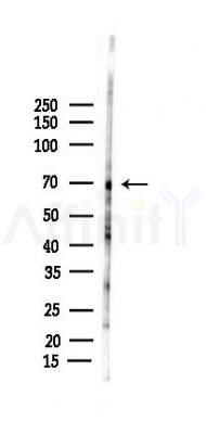 AIRE Antibody - Western blot analysis of lysates from Rat testis, using AIRE Antibody at 1/1000 dilution.