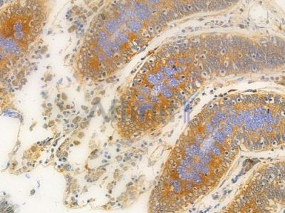 GGT1 Antibody - DF6610 at 1/100 staining human normal colon tissue by IHC-P.