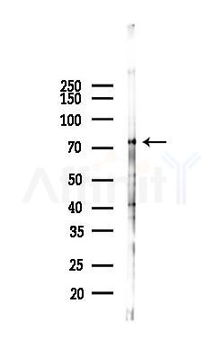 MX1 Antibody - Western blot analysis of lysates from Mouse lung, using MX1 Antibody at 1/1000 dilution.