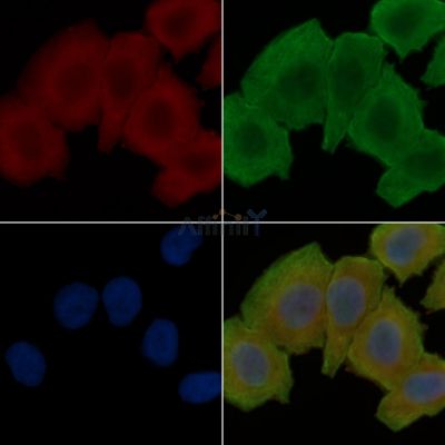 ORM1 Antibody - DF6623 staining Hela cells(30min of UV treatment) by IF/ICC.