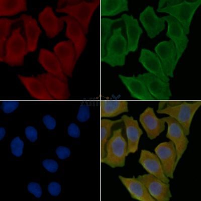 VIP Antibody - DF6627 staining Hela cells(30min of UV treatment) by IF/ICC.