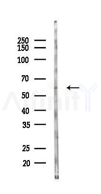 CADM1 Antibody - Western blot analysis of lysates from EC304 cells(starvation 24h treatment), using CADM1 Antibody at 1/1000 dilution.
