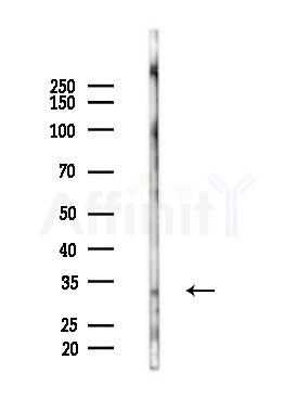 MT2A Antibody - Western blot analysis of lysates from COLO205 cells(starvation 24h treatment), using MT2A Antibody at 1/1000 dilution.