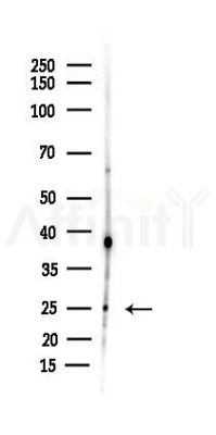 Claudin 7 Antibody - Western blot analysis of lysates from B16F10-LUC cells(starvation 24h treatment), using Claudin 7 Antibody at 1/1000 dilution.