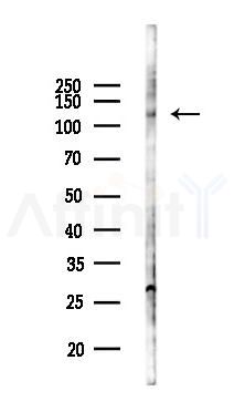 FGFR1 Antibody - Western blot analysis of lysates from COLO205 cells(UV 30min treatment), using FGFR1 Antibody at 1/1000 dilution.