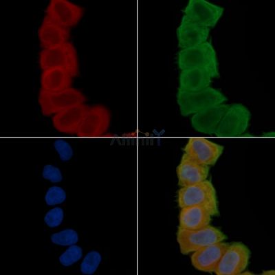 UAP1 Antibody - DF6843 staining Hela cells(30min of UV treatment) by IF/ICC.