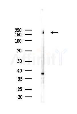 THBS1 Antibody - Western blot analysis of lysates from 293 cells(starvation 24h treatment), using THBS1 Antibody at 1/1000 dilution.