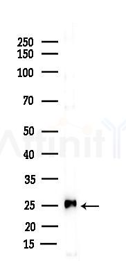 THY1 Antibody - Western blot analysis of lysates from B16F10-LUC cells(starvation 24h treatment), using THY1 Antibody at 1/1000 dilution.