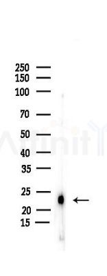 THY1 Antibody - Western blot analysis of lysates from Rat testis, using THY1 Antibody at 1/1000 dilution.