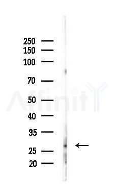 UBB Antibody - Western blot analysis of lysates from Mouse liver, using UBB Antibody at 1/1000 dilution.
