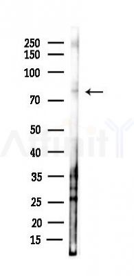 Sumo 1 Antibody - Western blot analysis of lysates from B16F10-LUC cells(starvation 24h treatment), using Sumo 1 Antibody at 1/1000 dilution.