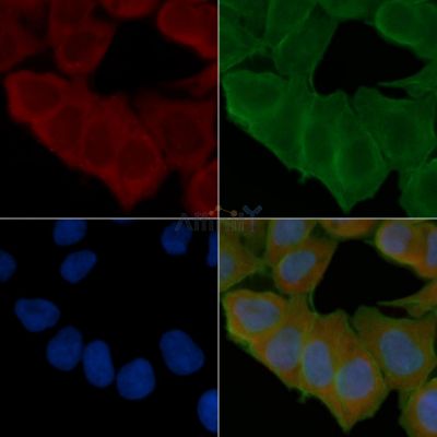 VEGFB Antibody - DF6855 staining Hela cells(24h of starvation treatment) by IF/ICC.