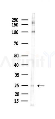 IL10 Antibody - Western blot analysis of lysates from B16F10-LUC cells(starvation 24h treatment), using IL10 Antibody at 1/1000 dilution.