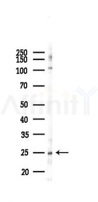 IL10 Antibody - Western blot analysis of lysates from 293 cells(LPS 4h treatment), using IL10 Antibody at 1/1000 dilution.