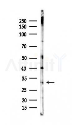 TOLLIP Antibody - Western blot analysis of lysates from Rat brain, using TOLLIP Antibody at 1/1000 dilution.