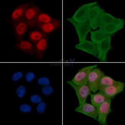Di-Methyl-Histone H3 (Lys4)/H3K4me2 Antibody - DF6934 staining Hela cells(24h of starvation treatment) by IF/ICC.