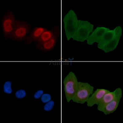 Mono-Methyl-Histone H3 (Lys9)/H3K9me1 Antibody - DF6936 staining Hela cells(24h of starvation treatment) by IF/ICC.