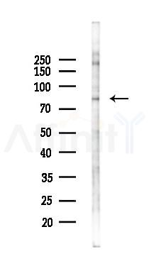 FOXM1 Antibody - Western blot analysis of lysates from K562 cells(starvation 24h treatment), using FOXM1 Antibody at 1/1000 dilution.