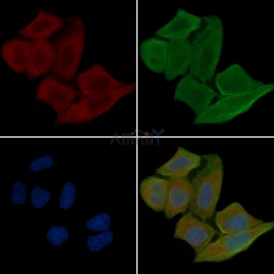 ADIPOQ Antibody - DF7000 staining Hela cells(30min of UV treatment) by IF/ICC.