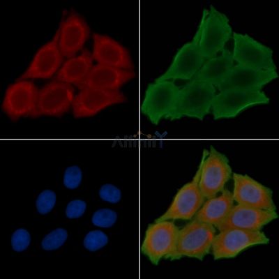 MMP14 Antibody - DF7005 staining Hela cells(30min of UV treatment) by IF/ICC.